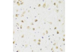 Immunohistochemistry of paraffin-embedded rat brain using PAWR Antibody (ABIN1874043) at dilution of 1:100 (40x lens). (PAWR anticorps)