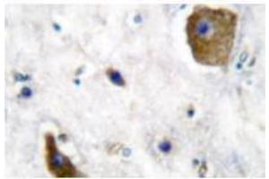 Image no. 1 for anti-Glutamate Decarboxylase 1 (Brain, 67kDa) (GAD1) antibody (ABIN265428) (GAD anticorps)