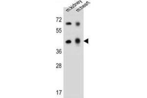 Western Blotting (WB) image for anti-Adenosine Deaminase-Like Protein (ADAL) antibody (ABIN2997438)