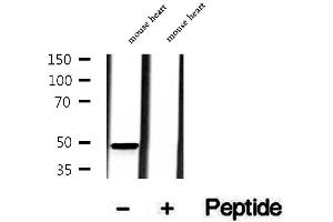 Western blot analysis of extracts of mouse heart tissue, using MMP28 antibody. (MMP28 anticorps  (Internal Region))