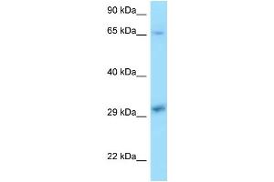 WB Suggested Anti-XPA Antibody Titration: 1. (XPA anticorps  (C-Term))