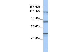 WB Suggested Anti-CSE1L Antibody Titration:  0. (Exportin 2 anticorps  (N-Term))