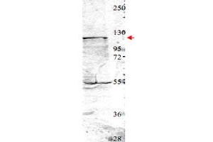 Western blot using NEDD4 polyclonal antibody  shows detection of a 115 kDa band corresponding to endogenous NEDD4 (arrowhead) in MDA-MB-435 cell lysates. (NEDD4 anticorps  (Internal Region))