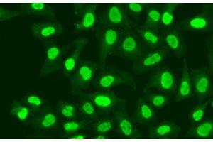 Immunofluorescence analysis of A549 cells using RFC1 Polyclonal Antibody (RFC1 anticorps)