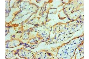 Immunohistochemical of paraffin-embedded Human placenta tissue using ABIN7166415 at dilution of 1:200. (Transglutaminase 2 anticorps)