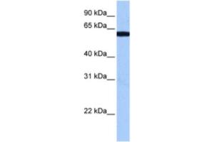 Western Blotting (WB) image for anti-RNA Binding Motif Protein 14 (RBM14) antibody (ABIN2462204) (RBM14 anticorps)