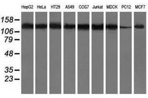 Image no. 2 for anti-Histone Deacetylase 6 (HDAC6) antibody (ABIN1498620)