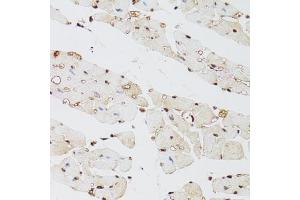Immunohistochemistry of paraffin-embedded mouse heart using KDM4A antibody (ABIN6131821, ABIN6142793, ABIN6142795 and ABIN6223960) at dilution of 1:100 (40x lens). (KDM4A anticorps  (AA 585-815))