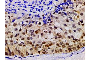 ABIN6267554 at 1/200 staining human gastric tissue sections by IHC-P.