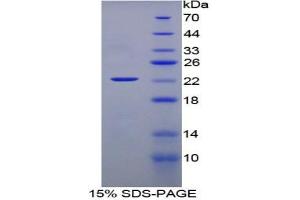 SDS-PAGE of Protein Standard from the Kit (Highly purified E. (IFNA Kit CLIA)