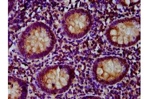 anti-Patatin-Like phospholipase Domain Containing 5 (PNPLA5) (AA 90-205) antibody