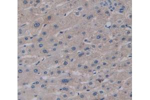 Used in DAB staining on fromalin fixed paraffin- embedded Kidney tissue