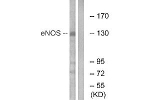 Western blot analysis of extracts from Jurkat cells, using eNOS (Ab-615) antibody.