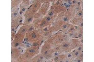 IHC-P analysis of Human Tissue, with DAB staining. (MT1 anticorps  (AA 1-61))