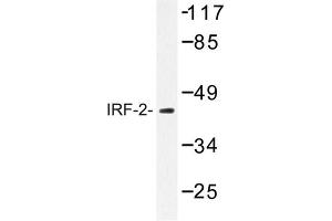 Image no. 1 for anti-Interferon Regulatory Factor 2 (IRF2) antibody (ABIN272167) (IRF2 anticorps)