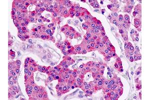 Human, Pancreas, Islets: Formalin-Fixed Paraffin-Embedded (FFPE)