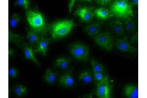 Image no. 5 for anti-Keratin 8 (KRT8) (AA 91-381) antibody (ABIN1491713)