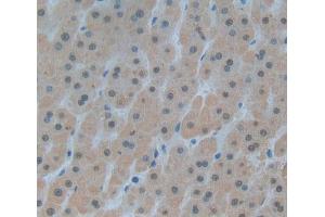 Used in DAB staining on fromalin fixed paraffin- embedded liver tissue (DKC1 anticorps  (AA 298-465))
