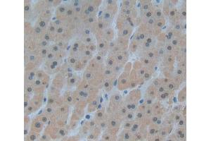 Used in DAB staining on fromalin fixed paraffin- embedded liver tissue (DKC1 anticorps  (AA 298-465))