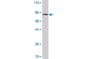 Western Blot detection against Immunogen (73. (Septin 6 anticorps  (AA 1-434))