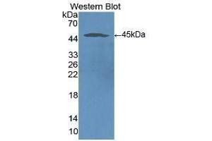 Detection of Recombinant ICAM1, Human using Monoclonal Antibody to Intercellular Adhesion Molecule 1 (ICAM1) (ICAM1 anticorps  (AA 41-464))