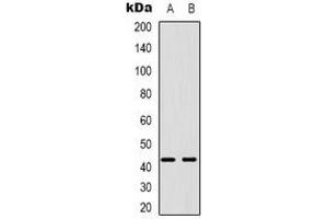 Western blot analysis of PABPC5 expression in U87MG (A), K562 (B) whole cell lysates. (PABPC5 anticorps)