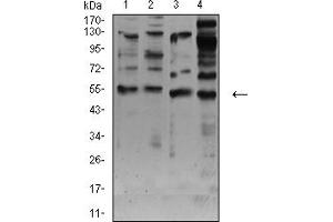 Western blot analysis using CHRNA7 mouse mAb against membrane protein lysate of C6 (1), membrane protein lysate of SK-N-SH (2), C6 (3), and HepG2 (4) cell lysate.