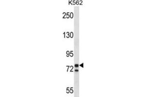 Western Blotting (WB) image for anti-Proprotein Convertase Subtilisin/kexin Type 7 (PCSK7) antibody (ABIN2997695) (PCSK7 anticorps)