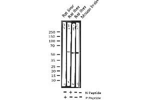 Western blot analysis of Phospho-SGK (Ser422) expression in various lysates