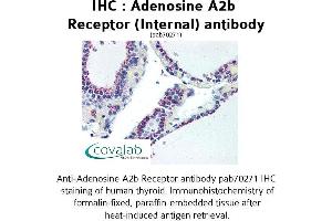 Image no. 2 for anti-Adenosine A2b Receptor (ADORA2B) (Internal Region) antibody (ABIN1731551) (Adenosine A2b Receptor anticorps  (Internal Region))