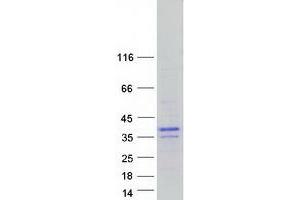 Validation with Western Blot