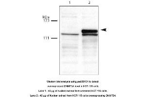 Image no. 1 for anti-Deoxyribonucleic Acid (DNA) (AA 10-118) antibody (ABIN363410) (DNA anticorps  (AA 10-118))