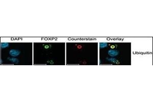 Characterization of FOXP2 Isoforms.