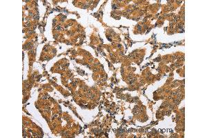 Immunohistochemistry of Human brain  using CXCL14 Polyclonal Antibody at dilution of 1:60 (CXCL14 anticorps)