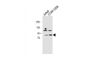 All lanes :PLK2 (SNK) Antibody (C-term) at 1:1000 dilution Lane 1: Jurkat whole cell lysate Lane 2: CCRF-CEM whole cell lysate Lysates/proteins at 20 μg per lane. (PLK2 anticorps  (C-Term))