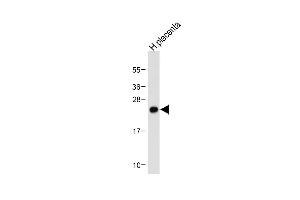 Anti-Neurogenin3 Antibody (N-term) at 1:500 dilution + Human placenta tissue lysate Lysates/proteins at 20 μg per lane.