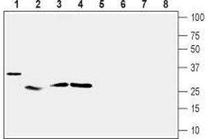 Western blot analysis of mouse heart (lanes 1 and 5), rat skeletal muscle (lanes 2 and 6), rat adipose tissue (lanes 3 and 7) and rat pancreas (lanes 4 and 8): - 1-4.