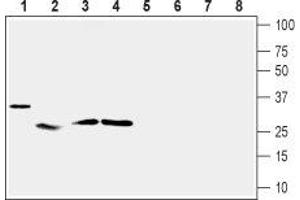 Western blot analysis of mouse heart (lanes 1 and 5), rat skeletal muscle (lanes 2 and 6), rat adipose tissue (lanes 3 and 7) and rat pancreas (lanes 4 and 8): - 1-4. (UCP2 anticorps  (Intracellular))
