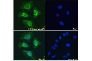 ABIN185364 Immunofluorescence analysis of paraformaldehyde fixed HeLa cells, permeabilized with 0. (Asporin anticorps  (Internal Region))
