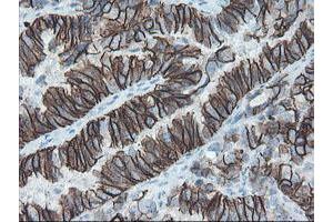 Image no. 5 for anti-Signal Recognition Particle Receptor, B Subunit (SRPRB) antibody (ABIN1501126)