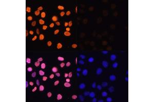 Immunofluorescence analysis of HeLa cells using Acetyl-Histone H3-K4 antibody (ABIN7267672) at dilution of 1:100.