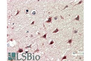 ABIN185538 (5µg/ml) staining of paraffin embedded Human Cerebral Cortex. (DCDC2 anticorps  (Internal Region))
