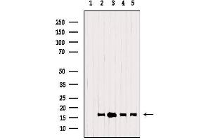 Western blot analysis of extracts from various samples, using TSPO Antibody. (TSPO anticorps  (C-Term))