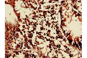 Immunohistochemistry of paraffin-embedded human appendix tissue using ABIN7158291 at dilution of 1:100
