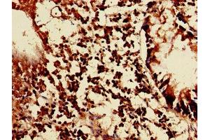 Immunohistochemistry of paraffin-embedded human appendix tissue using ABIN7158291 at dilution of 1:100 (LAIR1 anticorps  (AA 22-165))
