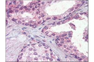 Human Prostate (formalin-fixed, paraffin-embedded) stained with IFNAR2followed by biotinylated anti-goat IgG secondary antibody, alkaline phosphatase-streptavidin and chromogen. (IFNAR2 anticorps  (Internal Region))