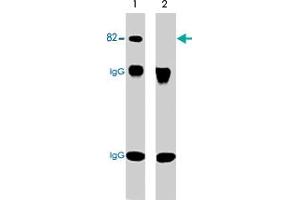Western blot analysis of immunoprecipitates from neonatal rat brain lysate using anti-PRKCA antibody. (PKC alpha anticorps  (pSer657, pTyr658))