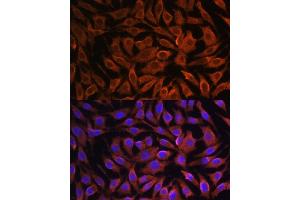 Immunofluorescence analysis of L929 cells using [KO] GIT1 antibody (ABIN7267383) at dilution of 1:100.