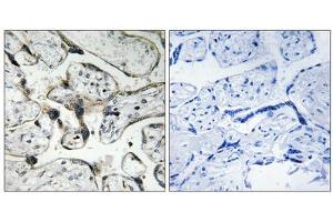 Immunohistochemistry analysis of paraffin-embedded human placenta tissue using PAK1/2 (epitope around residue 199) antibody. (PAK1/2 anticorps  (Ser199))