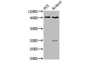 Western Blot Positive WB detected in: PC-3 whole cell lysate, Rat kidney tissue All lanes: CDK11A antibody at 4 μg/mL Secondary Goat polyclonal to rabbit IgG at 1/50000 dilution Predicted band size: 92, 91, 46, 19, 63, 50 kDa Observed band size: 92 kDa (Cyclin-Dependent Kinase 11A (CDK11A) (AA 5-216) anticorps)